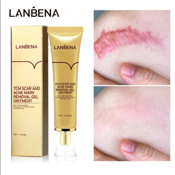 LANBENA Scar removal cream to lighten wounds